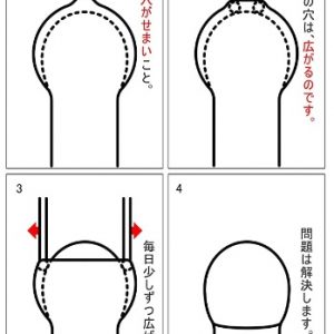 真性包茎を放置するリスク「恥垢・悪臭・感染症」をキトー君で今すぐリセットする方法