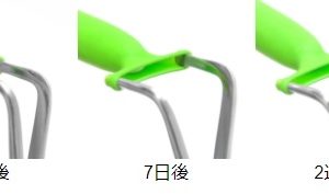 「皮オナ棒」や「ナイトキャップ」で失敗した人へ。キトー君へ乗り換えて成功した人の共通点